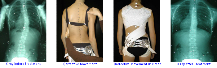 Picture-3-for-CONDITION-WE-TREAT-page